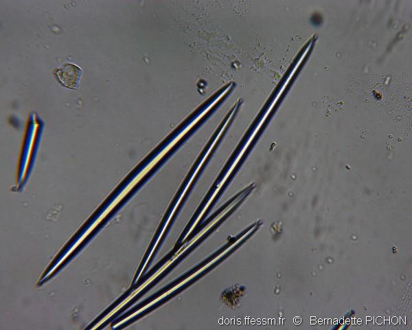spongilla_lacustris_spicules-bpi-10